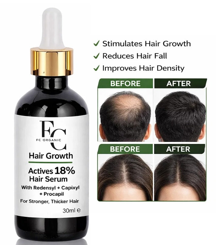 Herbal Hair Growth Serum 30ml