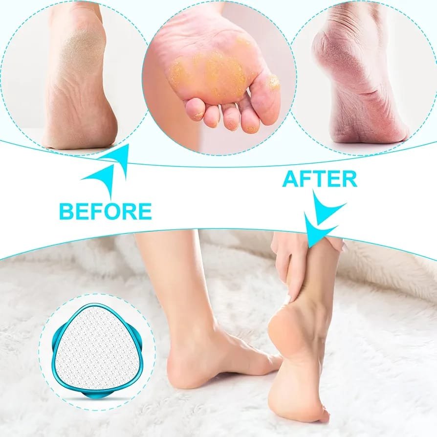 2 in 1 Double-Sided Nano Glass Callus Remover &amp; Crystal Hair Eraser – Safe &amp; Quick Foot File, Dead Skin &amp; Hard Callus Remover, Painless Epilator for Women, Portable Pedicure Tool (Random Color)
